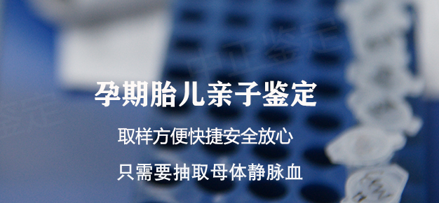 石家庄胎儿如何办理血缘检测,石家庄无创怀孕亲子鉴定多少钱 石家庄胎儿如何办理血缘检测,石家庄无创怀孕亲子鉴定多少钱