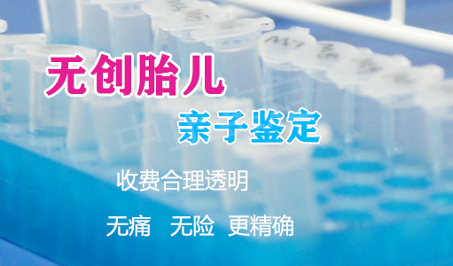 石家庄怀孕九周能做怀孕亲子鉴定吗, 石家庄怀孕九周能做怀孕亲子鉴定吗,