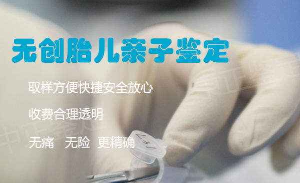 石家庄胎儿亲子鉴定条件和流程,石家庄哪里可以做产前亲子鉴定 石家庄胎儿亲子鉴定条件和流程,石家庄哪里可以做产前亲子鉴定